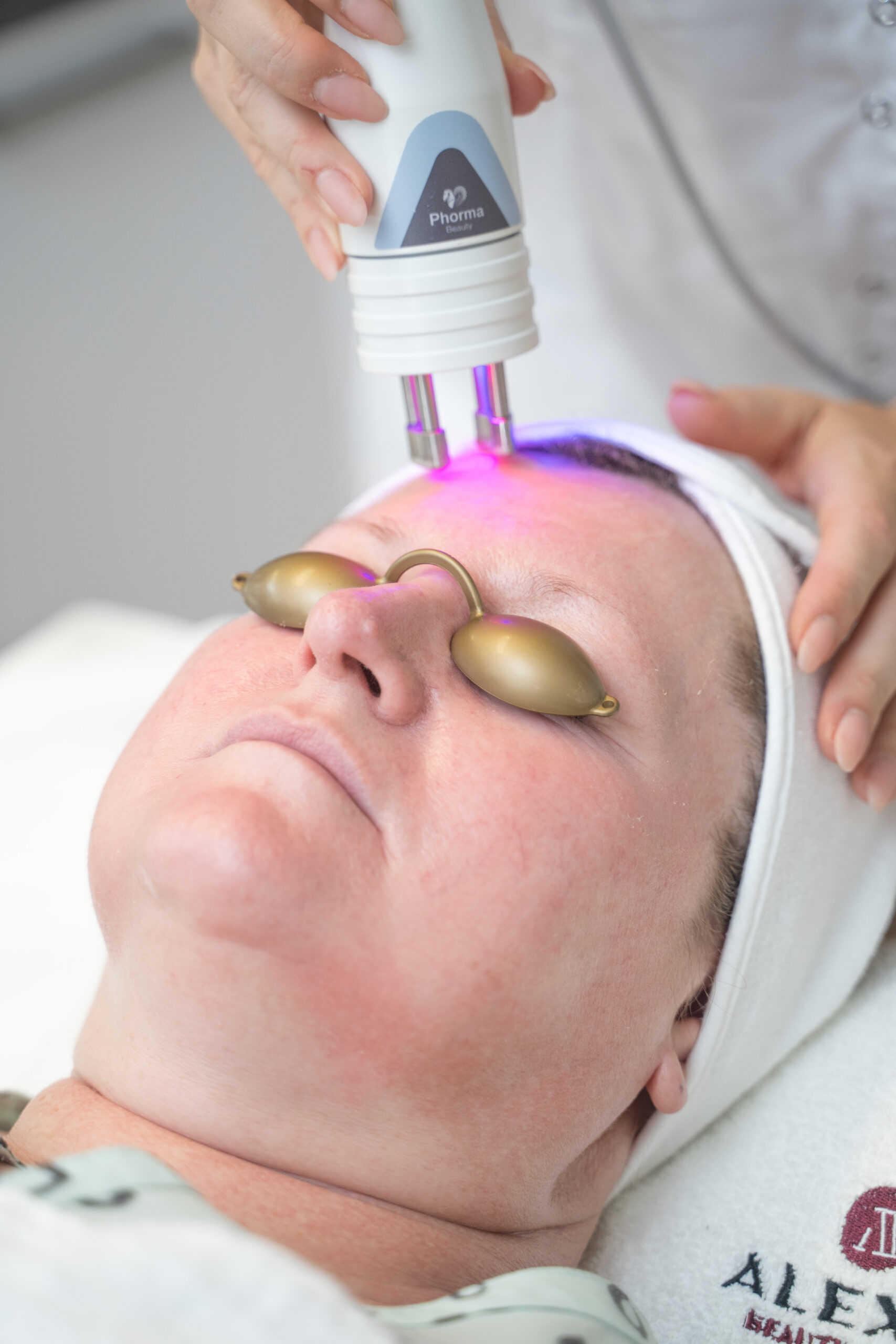 Laserová revitalizácia pleť 50+